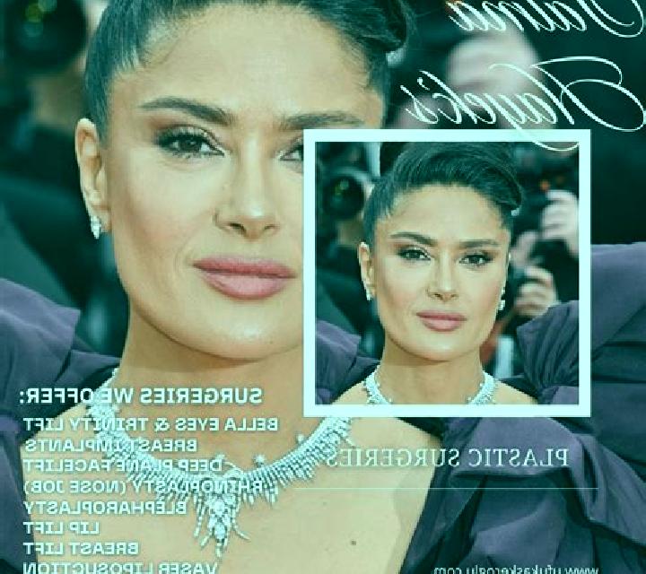 Rosa 2 Villaco escort