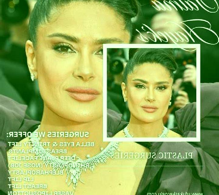 Selene 2 Albunol escort
